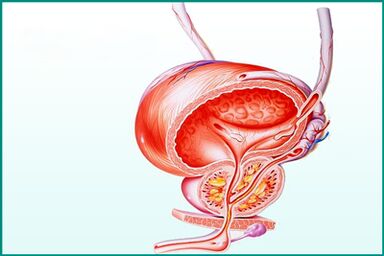 A inflamação da próstata na prostatite aguda é uma limitação para o sexo