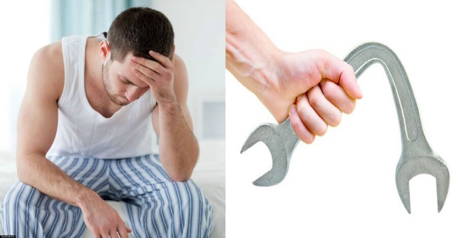 Sintomas de prostatite