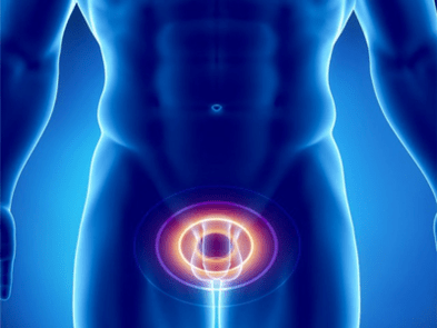 Prostatite – inflamação da próstata em um homem