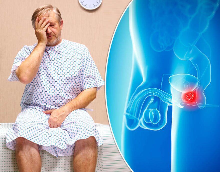 Um homem com prostatite está sendo diagnosticado com uma doença